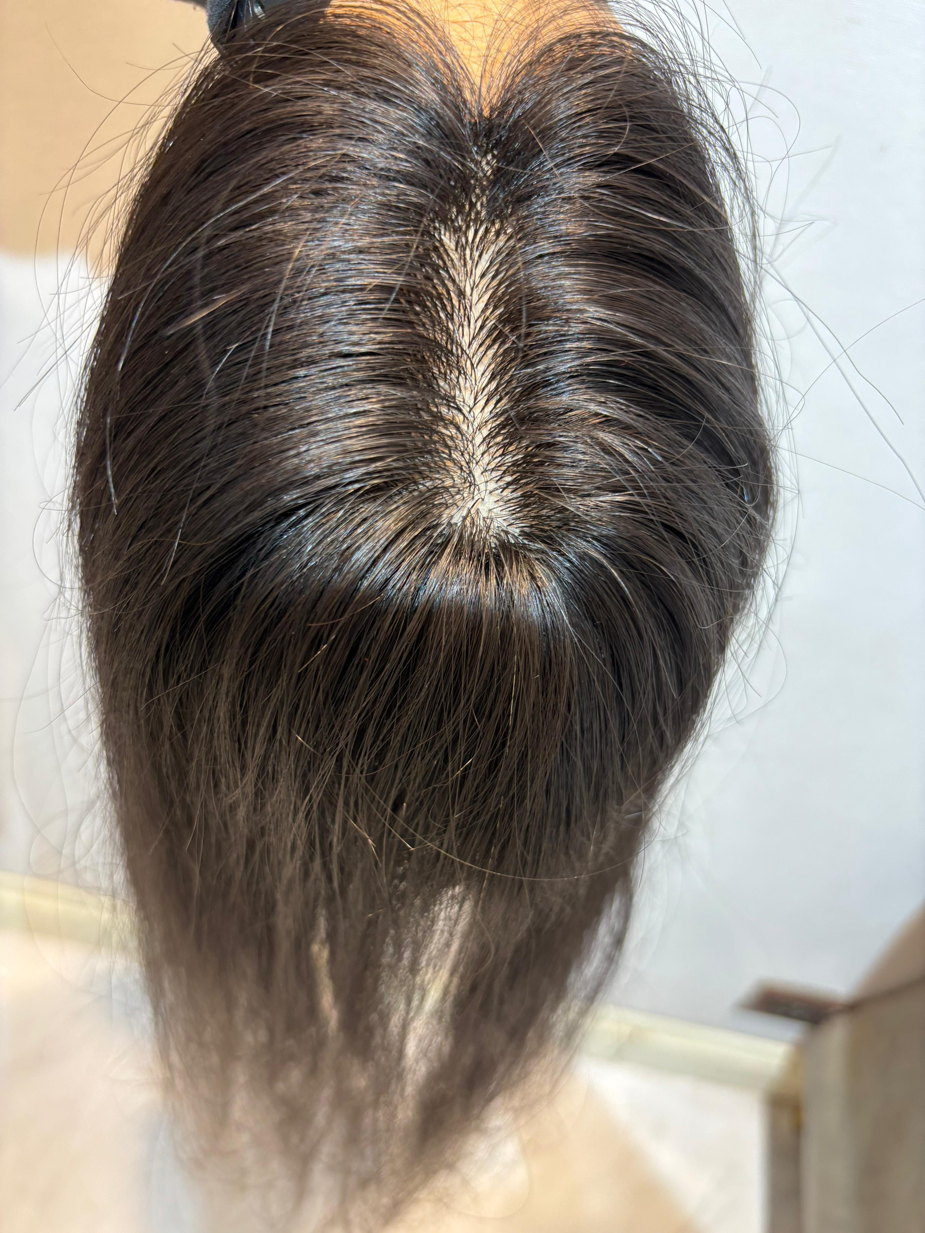 Hair Topper for PCOS Hair Loss | Silk Base | Natural Black | Straight | Remy Hair India-0